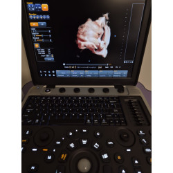 Máquina de ultrasonido Chison SonoBook 9 2025 - Sonda convexa 4D, garantía extendida